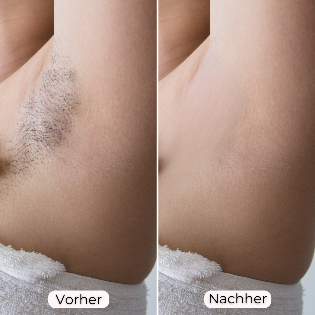 Glowea 3-in-1 – Dauerhaft seidig glatte Haut