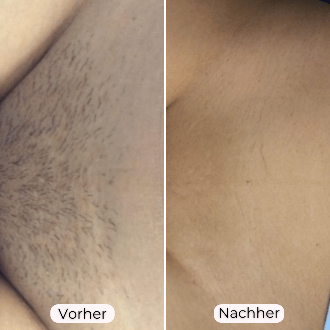 Glowea 3-in-1 – Dauerhaft seidig glatte Haut