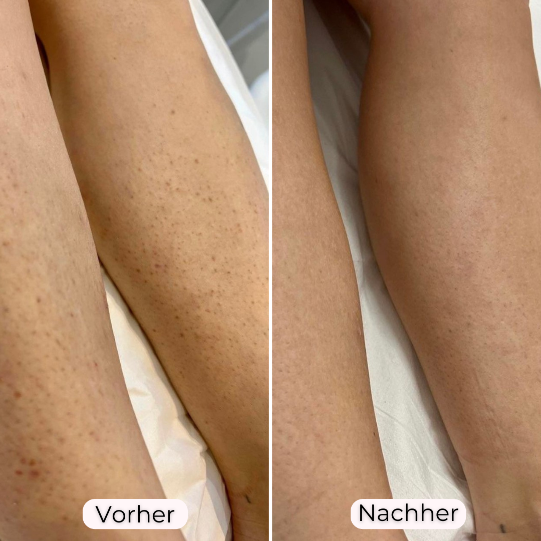 Glowea 3-in-1 – Dauerhaft seidig glatte Haut