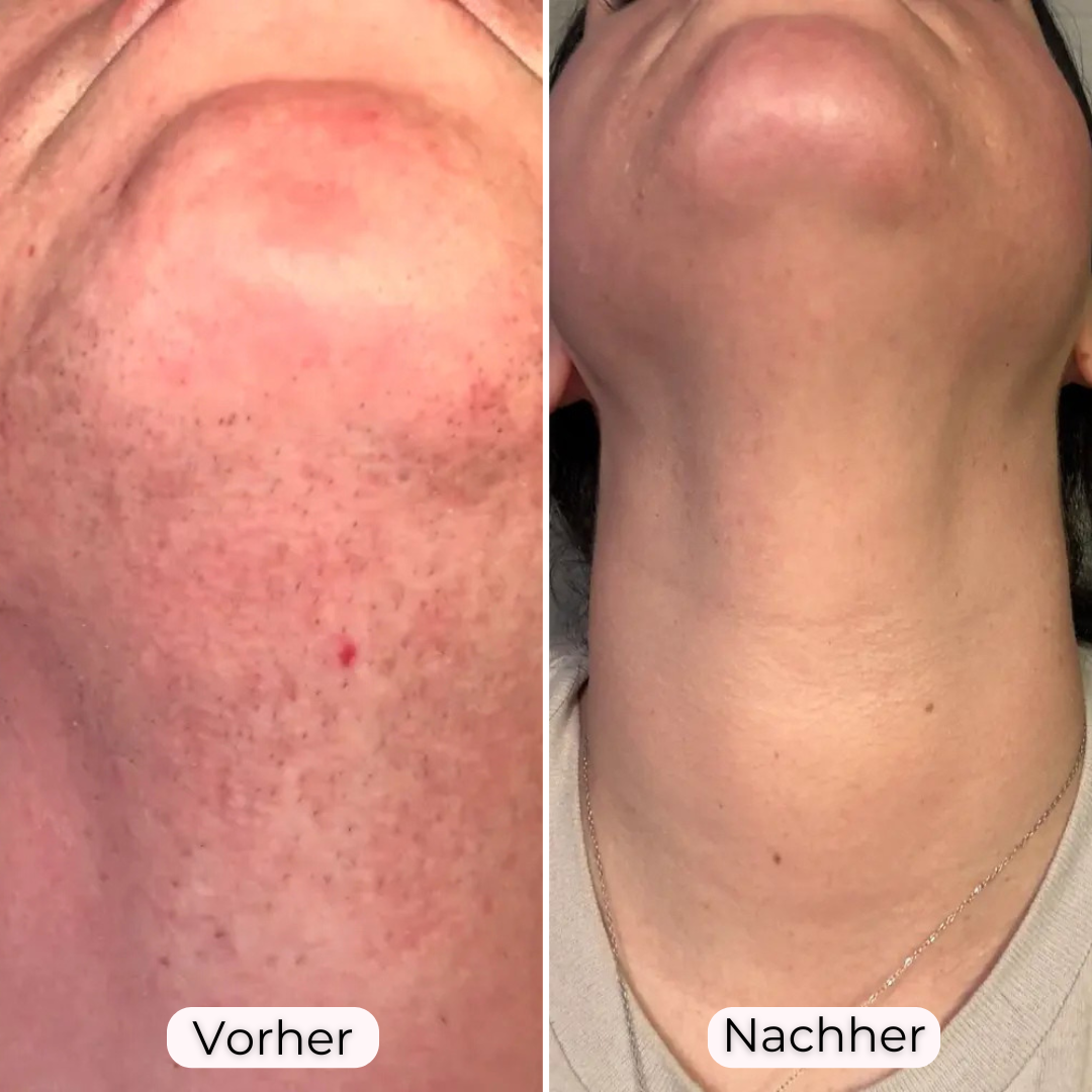 Glowea 3-in-1 – Dauerhaft seidig glatte Haut