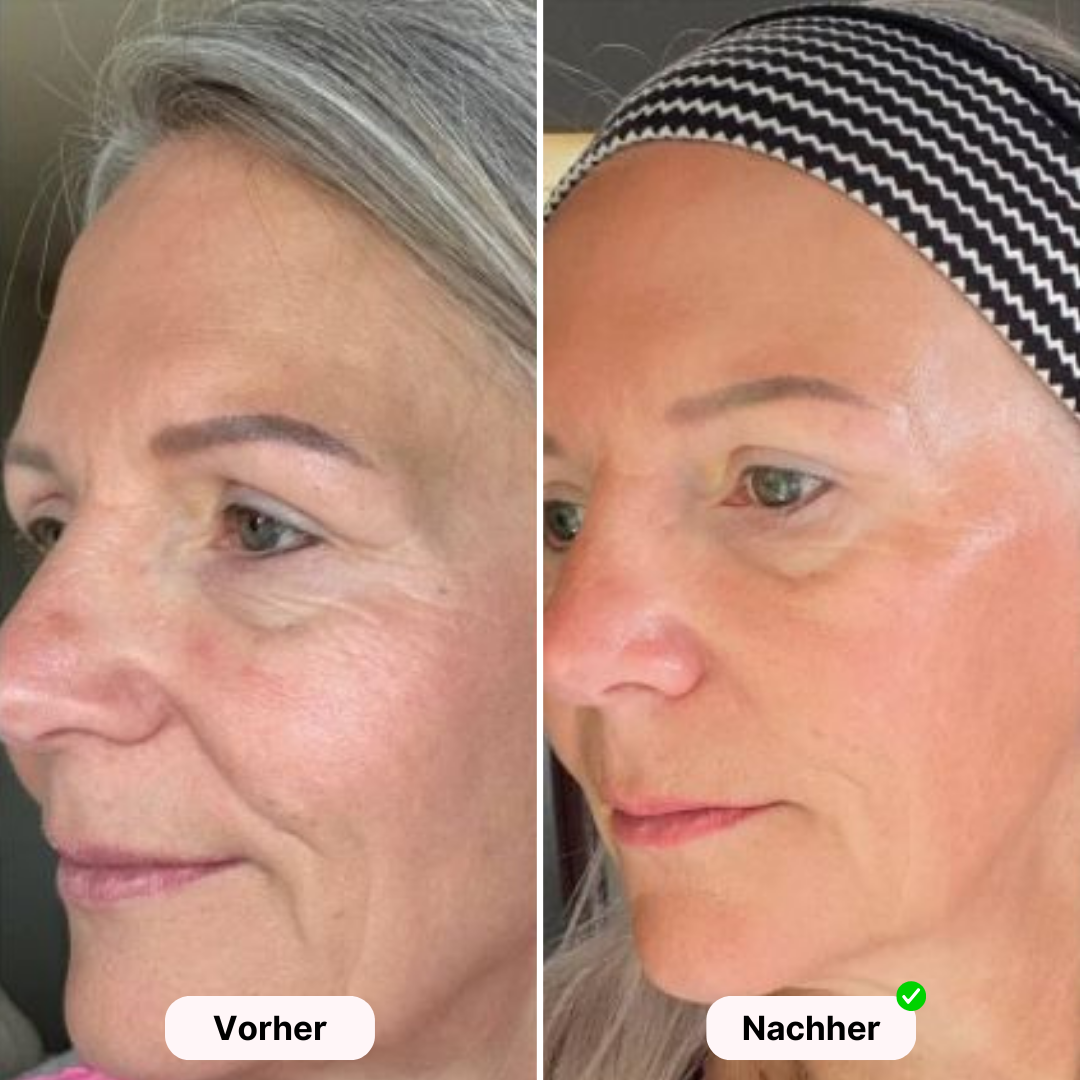 Glowea SkinPro - Für strahlende und gesunde Haut