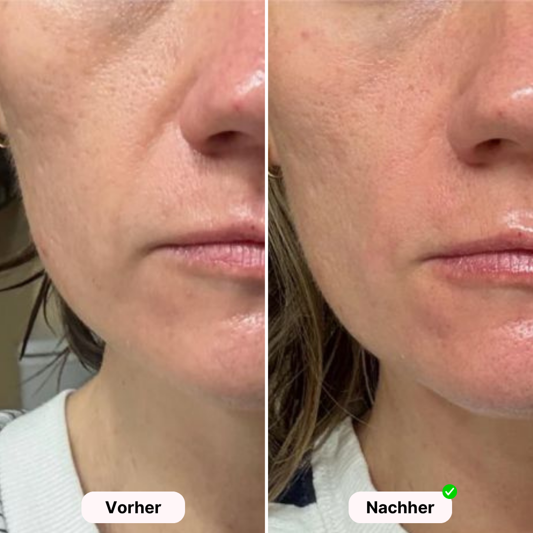 Glowea SkinPro - Für strahlende und gesunde Haut
