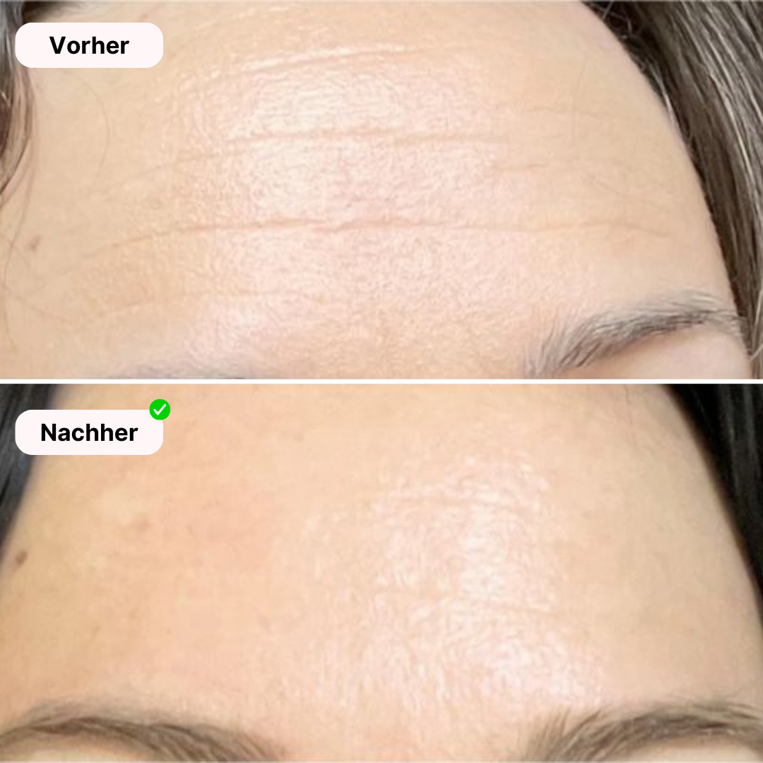 Glowea SkinPro - Für strahlende und gesunde Haut