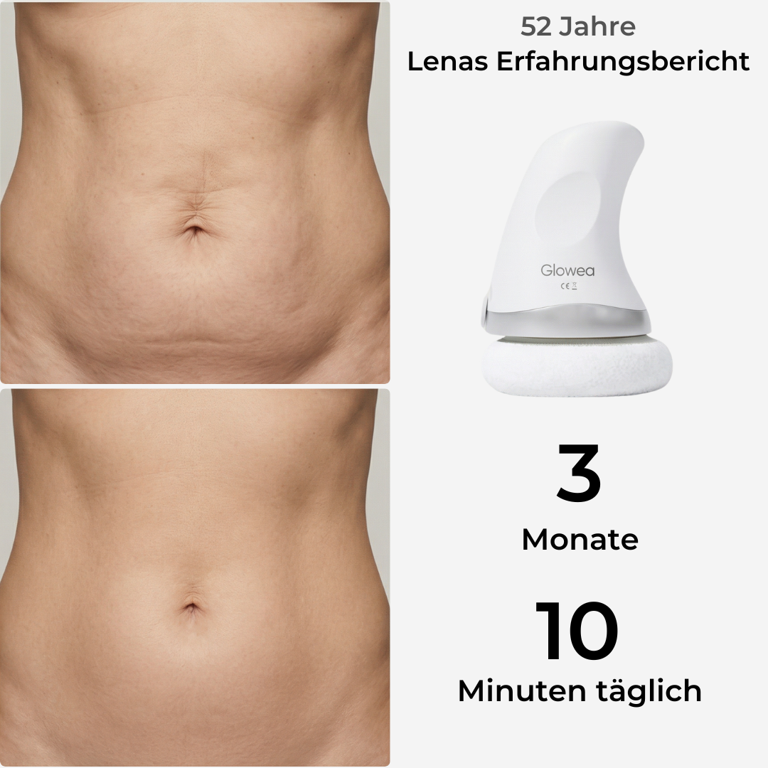 BodyLift Pro 2.0 – Die neue Generation der Hautstraffung