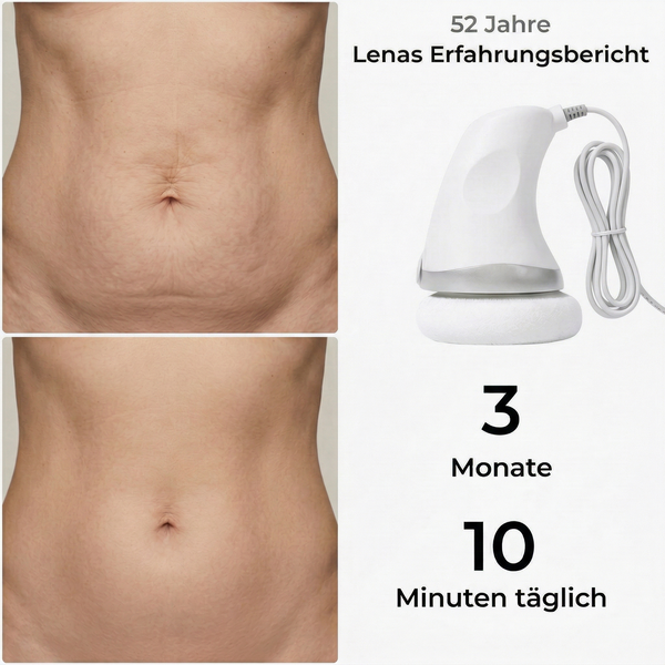 BodyLift Pro 2.0 – Die neue Generation der Hautstraffung